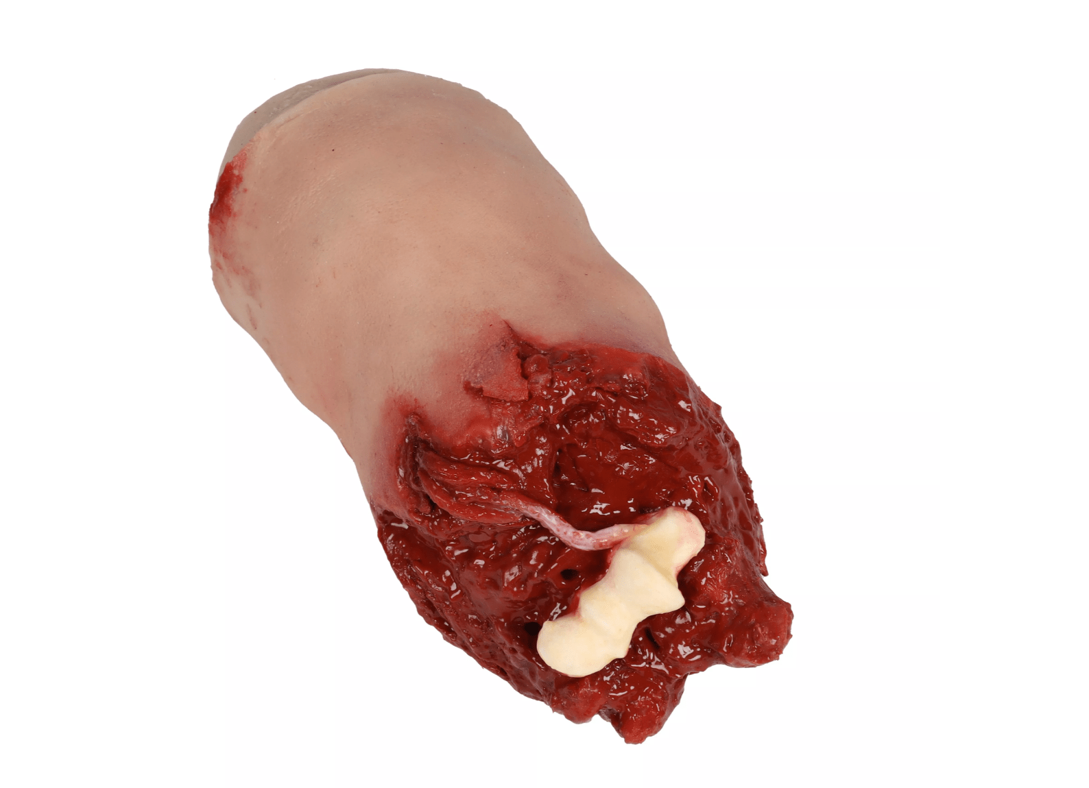 Amputierter Arm Task Trainer - Erler - Zimmer